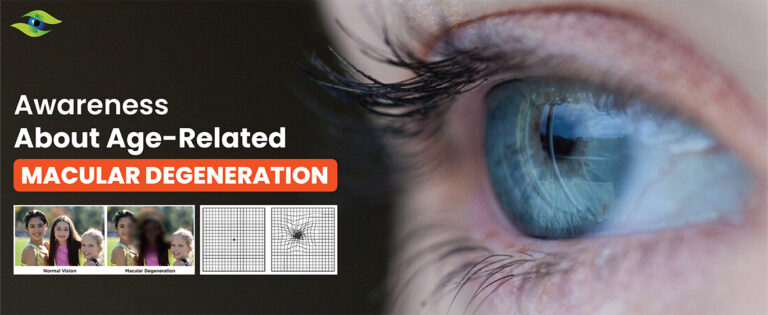 Macular Degeneration